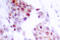 Myocyte Enhancer Factor 2A antibody, AP06220PU-N, Origene, Immunohistochemistry paraffin image 