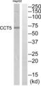 Chaperonin Containing TCP1 Subunit 5 antibody, abx014940, Abbexa, Western Blot image 