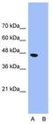 Gamma-Aminobutyric Acid Type A Receptor Pi Subunit antibody, GTX77697, GeneTex, Western Blot image 