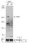 Tet Methylcytosine Dioxygenase 2 antibody, GTX124227, GeneTex, Western Blot image 