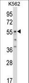 Ornithine Decarboxylase 1 antibody, LS-C163104, Lifespan Biosciences, Western Blot image 