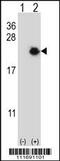 Eukaryotic Translation Initiation Factor 4E Binding Protein 1 antibody, MBS9209290, MyBioSource, Western Blot image 