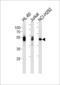 LCK Proto-Oncogene, Src Family Tyrosine Kinase antibody, LS-C203937, Lifespan Biosciences, Western Blot image 