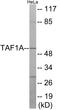 TATA-Box Binding Protein Associated Factor, RNA Polymerase I Subunit A antibody, EKC1823, Boster Biological Technology, Western Blot image 
