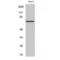 Potassium Voltage-Gated Channel Subfamily C Member 2 antibody, LS-C384287, Lifespan Biosciences, Western Blot image 