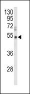 Vitronectin antibody, TA324937, Origene, Western Blot image 