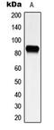 Phosphoinositide-3-Kinase Regulatory Subunit 1 antibody, LS-C354051, Lifespan Biosciences, Western Blot image 