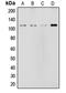 Notch Receptor 2 antibody, LS-C352592, Lifespan Biosciences, Western Blot image 