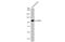 Angiotensin I Converting Enzyme 2 antibody, GTX635897, GeneTex, Western Blot image 