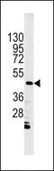 ILK1 antibody, MBS9202558, MyBioSource, Western Blot image 