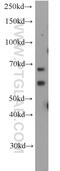 ALG6 Alpha-1,3-Glucosyltransferase antibody, 20753-1-AP, Proteintech Group, Western Blot image 