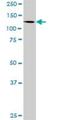 Zinc Finger And SCAN Domain Containing 20 antibody, H00007579-D01P, Novus Biologicals, Western Blot image 
