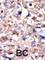 ABL Proto-Oncogene 1, Non-Receptor Tyrosine Kinase antibody, abx033625, Abbexa, Western Blot image 