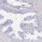 AKAP14 antibody, HPA060999, Atlas Antibodies, Immunohistochemistry frozen image 