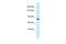 Formin Homology 2 Domain Containing 1 antibody, PA5-45226, Invitrogen Antibodies, Western Blot image 