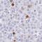 Variable Charge X-Linked antibody, HPA044996, Atlas Antibodies, Immunohistochemistry frozen image 