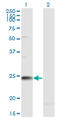 RAB7B, Member RAS Oncogene Family antibody, LS-C139323, Lifespan Biosciences, Western Blot image 