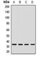 Crystallin Mu antibody, LS-C667913, Lifespan Biosciences, Western Blot image 