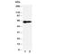 Interleukin 2 Receptor Subunit Beta antibody, R30696, NSJ Bioreagents, Western Blot image 