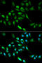 Alcohol Dehydrogenase 5 (Class III), Chi Polypeptide antibody, STJ22518, St John