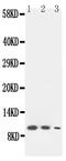 Lymphotactin antibody, PA1406, Boster Biological Technology, Western Blot image 