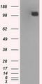 BUB1 Mitotic Checkpoint Serine/Threonine Kinase B antibody, TA500609S, Origene, Western Blot image 