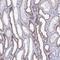 Acyl-CoA Synthetase Medium Chain Family Member 1 antibody, NBP1-91645, Novus Biologicals, Immunohistochemistry frozen image 