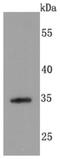 Syndecan 1 antibody, NBP2-67174, Novus Biologicals, Western Blot image 