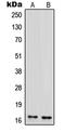 Interferon Induced With Helicase C Domain 1 antibody, LS-C353529, Lifespan Biosciences, Western Blot image 
