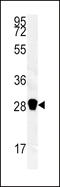 Carbonic Anhydrase 3 antibody, 63-076, ProSci, Western Blot image 