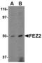 Fasciculation and elongation protein zeta-2 antibody, GTX85791, GeneTex, Western Blot image 