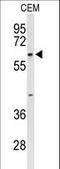 Trichoplein Keratin Filament Binding antibody, LS-C161775, Lifespan Biosciences, Western Blot image 