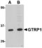 Growth Hormone Regulated TBC Protein 1 antibody, A15959-1, Boster Biological Technology, Western Blot image 