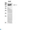Transforming Growth Factor Beta Receptor 3 antibody, LS-C814198, Lifespan Biosciences, Western Blot image 