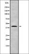 Beta-1,4-Galactosyltransferase 4 antibody, orb338070, Biorbyt, Western Blot image 