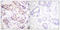 Protein Kinase C Alpha antibody, LS-C117772, Lifespan Biosciences, Immunohistochemistry paraffin image 