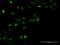 Zinc Finger And SCAN Domain Containing 18 antibody, MA5-22540, Invitrogen Antibodies, Immunofluorescence image 