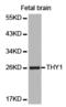 Thy-1 Cell Surface Antigen antibody, LS-C193073, Lifespan Biosciences, Western Blot image 