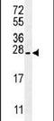 Prostate Stem Cell Antigen antibody, PA5-11463, Invitrogen Antibodies, Western Blot image 