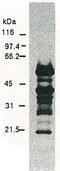 Cu-Zn superoxide dismutase-like protein A45R antibody, 65-061, BioAcademia Inc, Western Blot image 