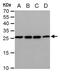 Triosephosphate Isomerase 1 antibody, GTX630780, GeneTex, Western Blot image 