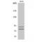 Transglutaminase 2 antibody, LS-C386404, Lifespan Biosciences, Western Blot image 