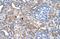 Polypeptide N-Acetylgalactosaminyltransferase 6 antibody, PA5-42935, Invitrogen Antibodies, Immunohistochemistry frozen image 