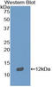 Semaphorin 3E antibody, LS-C296376, Lifespan Biosciences, Western Blot image 