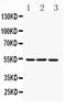 Fibrinogen Gamma Chain antibody, A00790-1, Boster Biological Technology, Western Blot image 
