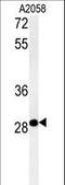 ADP Ribosylation Factor Like GTPase 14 Effector Protein antibody, LS-C156932, Lifespan Biosciences, Western Blot image 