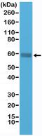 CD5 Molecule antibody, MA5-27903, Invitrogen Antibodies, Western Blot image 