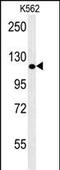 POTE Ankyrin Domain Family Member E antibody, A13768-1, Boster Biological Technology, Western Blot image 