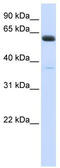 ALG6 Alpha-1,3-Glucosyltransferase antibody, TA341916, Origene, Western Blot image 