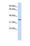 Rh Blood Group CcEe Antigens antibody, NBP1-69668, Novus Biologicals, Western Blot image 